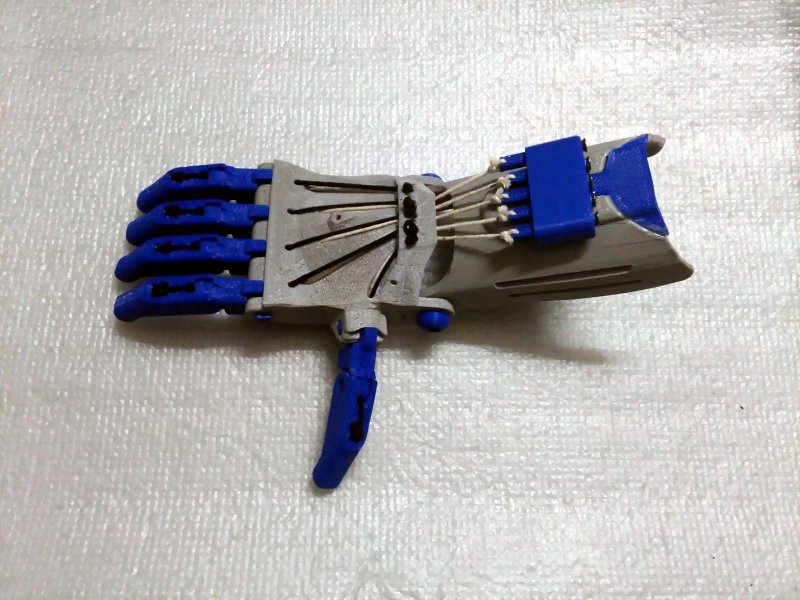 Protesis de mano